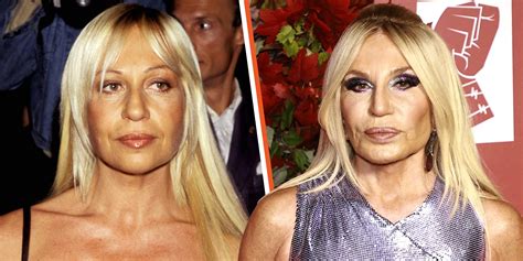 versace plastic surgery|what happened to donatella Versace.